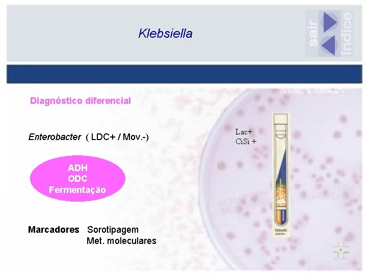 Klebsiella Diagnóstico diferencial Enterobacter ( LDC+ / Mov. -) ADH ODC Fermentação Marcadores Sorotipagem