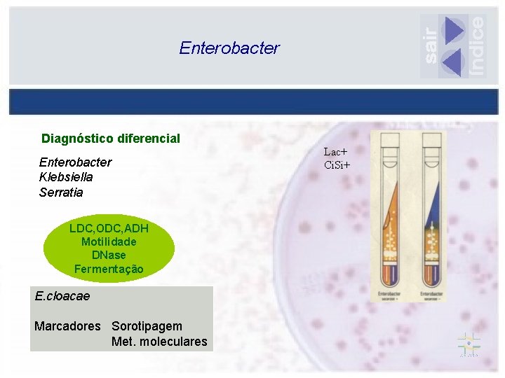 Enterobacter Diagnóstico diferencial Enterobacter Klebsiella Serratia LDC, ODC, ADH Motilidade DNase Fermentação E. cloacae