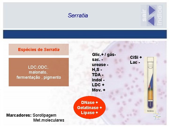Serratia Espécies de Serratia LDC, ODC, malonato, fermentação , pigmento Marcadores: Sorotipagem Met. moleculares
