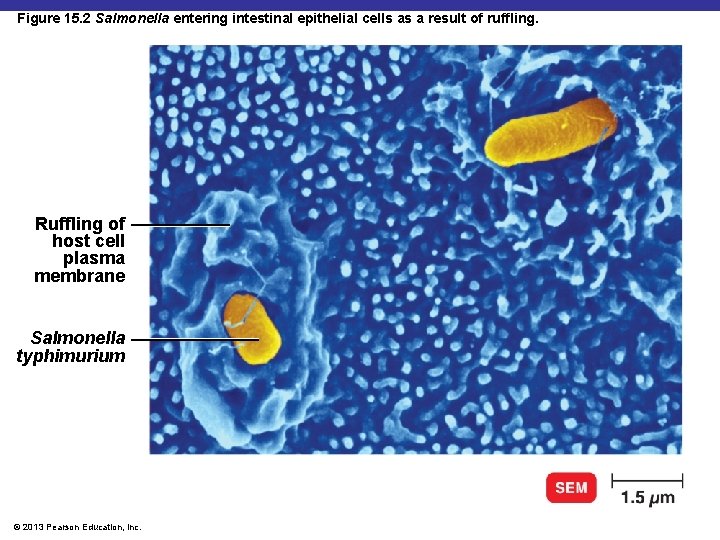 Figure 15. 2 Salmonella entering intestinal epithelial cells as a result of ruffling. Ruffling