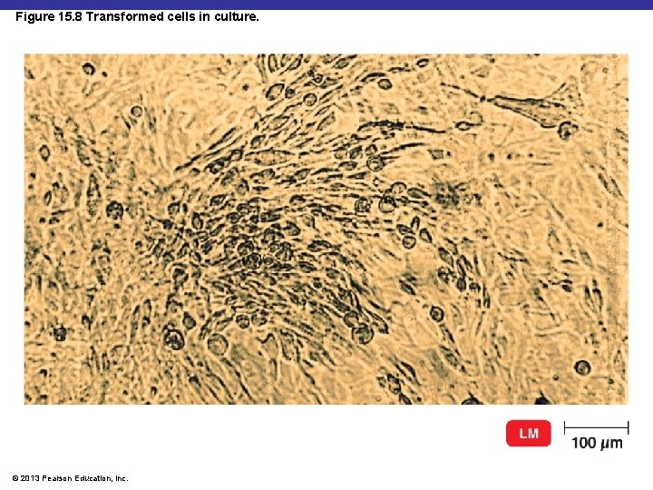 Figure 15. 8 Transformed cells in culture. © 2013 Pearson Education, Inc. 