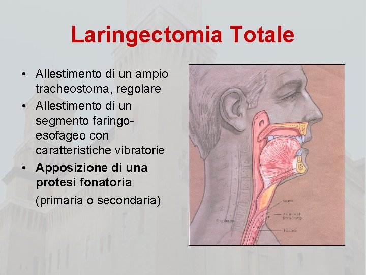 Laringectomia Totale • Allestimento di un ampio tracheostoma, regolare • Allestimento di un segmento