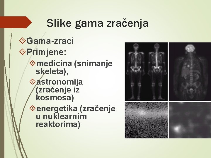 Slike gama zračenja Gama-zraci Primjene: medicina (snimanje skeleta), astronomija (zračenje iz kosmosa) energetika (zračenje Slike gama zračenja Gama-zraci Primjene: medicina (snimanje skeleta), astronomija (zračenje iz kosmosa) energetika (zračenje