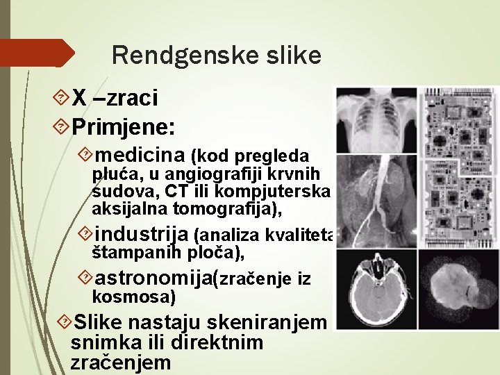 Rendgenske slike X –zraci Primjene: medicina (kod pregleda pluća, u angiografiji krvnih sudova, CT Rendgenske slike X –zraci Primjene: medicina (kod pregleda pluća, u angiografiji krvnih sudova, CT