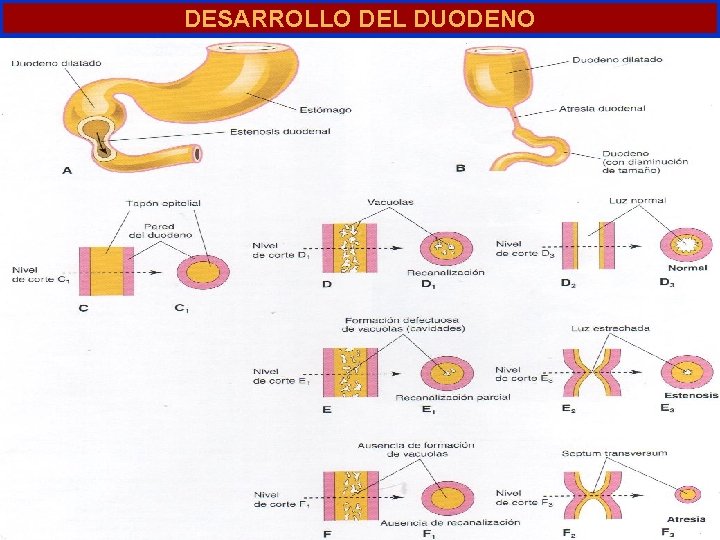 DESARROLLO DEL DUODENO DESARROLLO DEL DUODENO