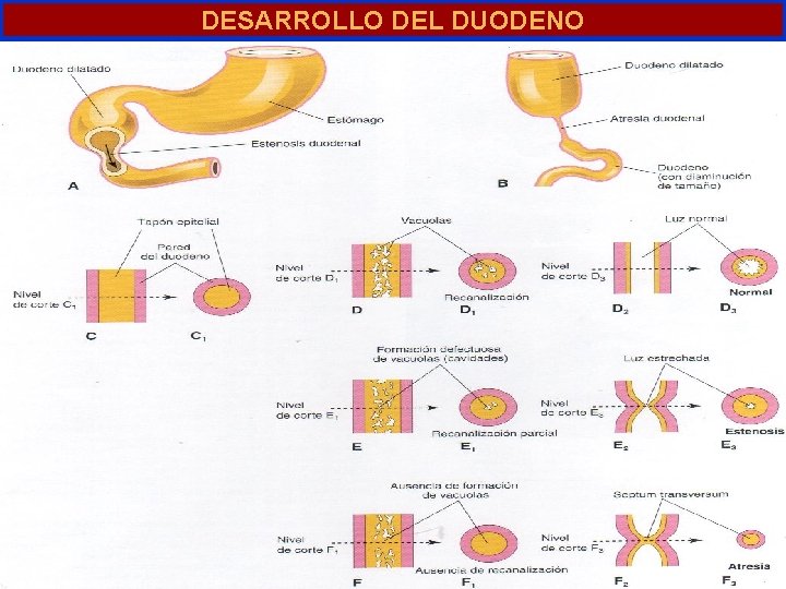 DESARROLLO DEL DUODENO 