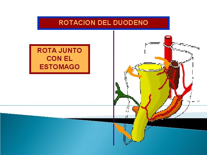 ROTACION DEL DUODENO ROTA JUNTO CON EL ESTOMAGO 