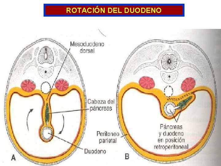 ROTACIÓN DEL DUODENO ROTACIÓN DEL DUODENO