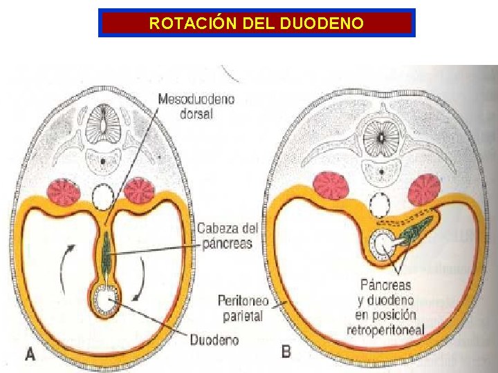 ROTACIÓN DEL DUODENO 