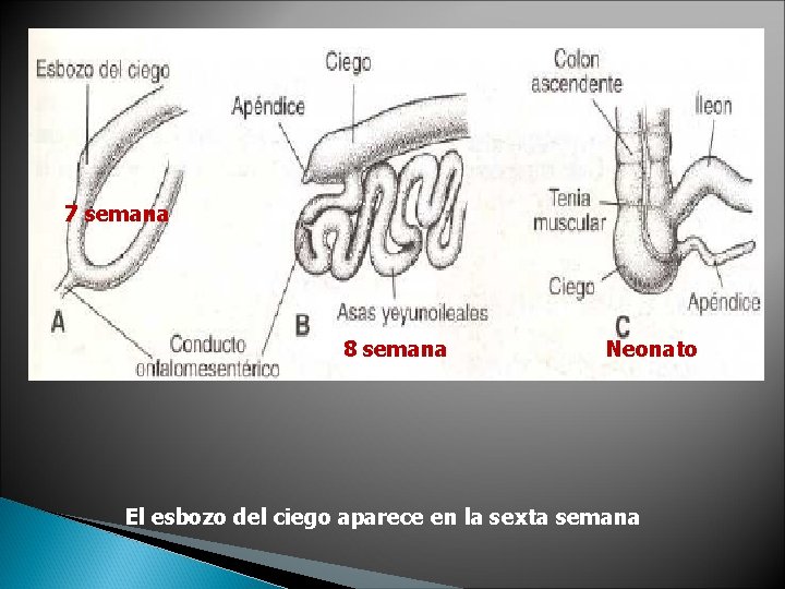 7 semana 8 semana Neonato El esbozo del ciego aparece en la sexta semana 7 semana 8 semana Neonato El esbozo del ciego aparece en la sexta semana