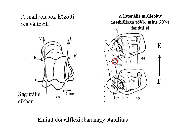 A malleolusok közötti rés változik A laterális malleolus mediálisan több, mint 30°-t fordul el