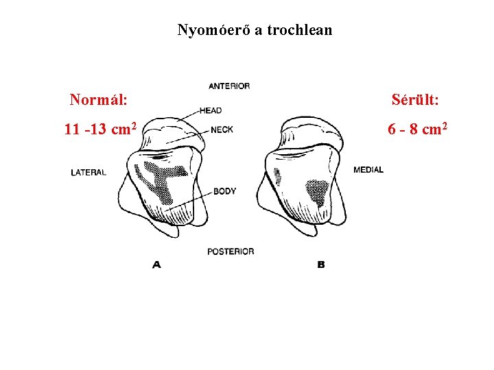 Nyomóerő a trochlean Normál: Sérült: 11 -13 cm 2 6 - 8 cm 2