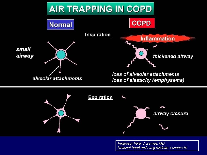 Professor Peter J. Barnes, MD National Heart and Lung Institute, London UK 