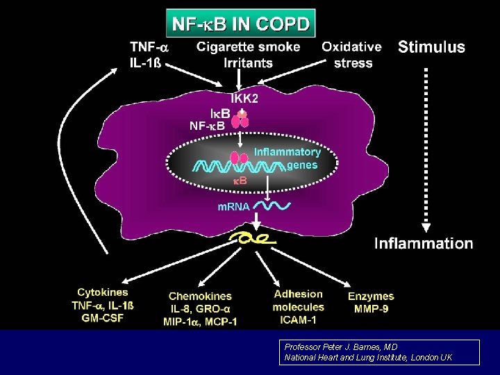 Professor Peter J. Barnes, MD National Heart and Lung Institute, London UK 