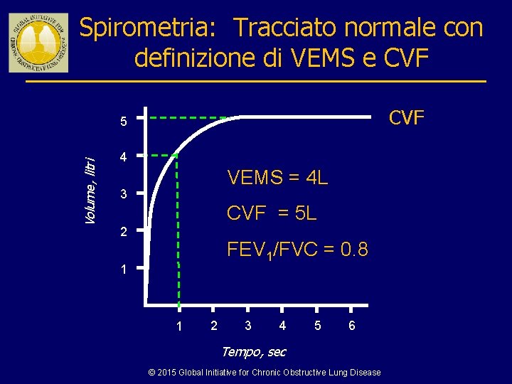Spirometria: Tracciato normale con definizione di VEMS e CVF Volume, litri 5 4 VEMS
