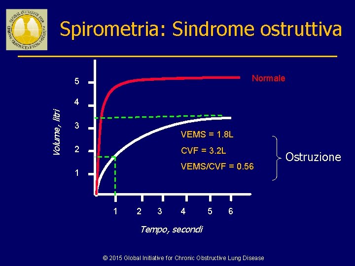 Spirometria: Sindrome ostruttiva Normale 5 Volume, litri 4 3 VEMS = 1. 8 L