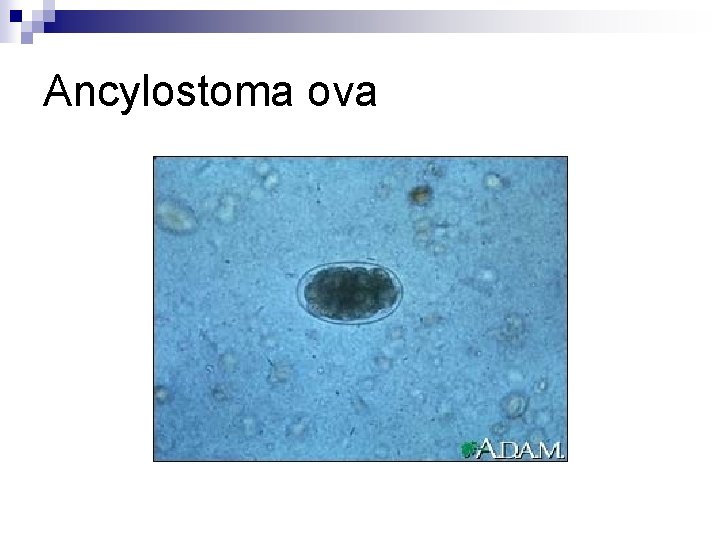 Ancylostoma ova 