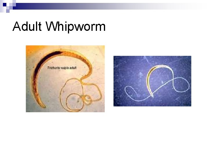 Adult Whipworm 