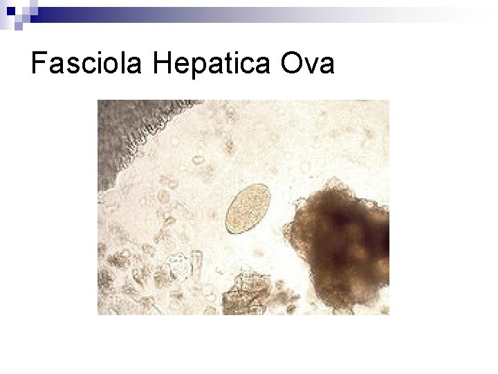 Fasciola Hepatica Ova 