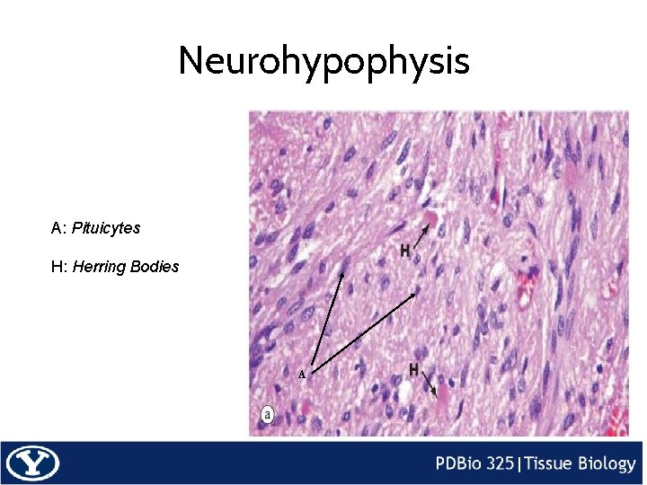 Neurohypophysis A: Pituicytes H: Herring Bodies A 