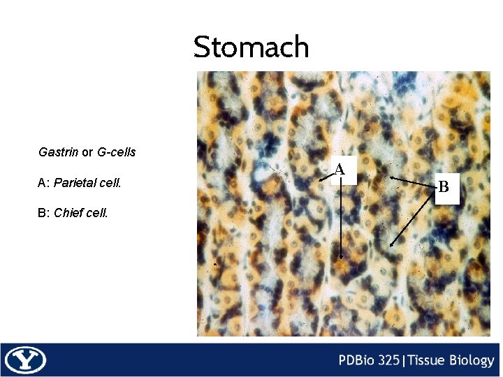 Stomach Gastrin or G-cells A: Parietal cell. B: Chief cell. A B 