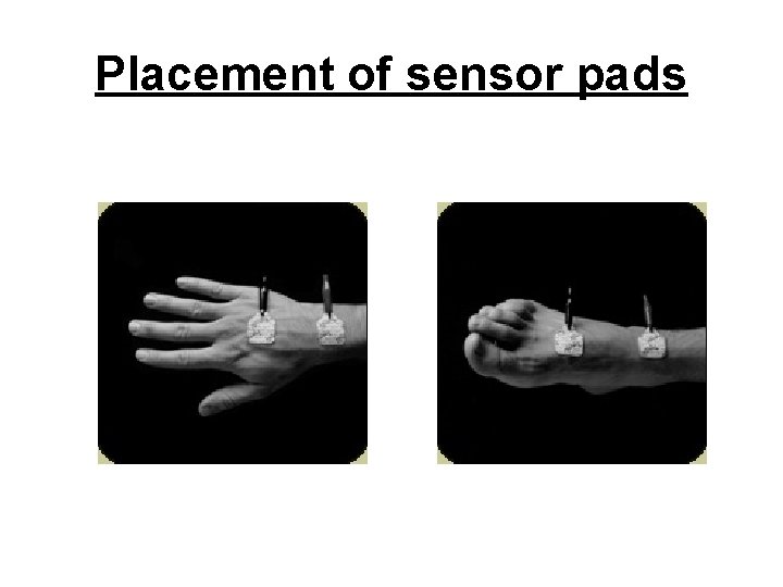 Placement of sensor pads 