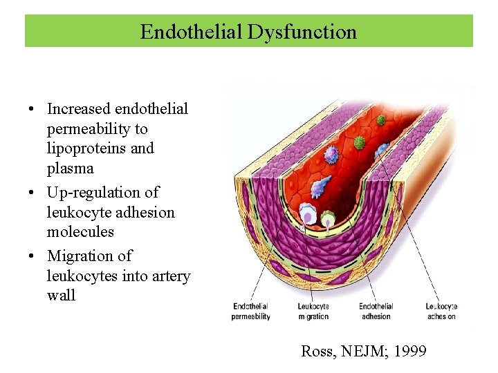 Endothelial Dysfunction • Increased endothelial permeability to lipoproteins and plasma • Up-regulation of leukocyte