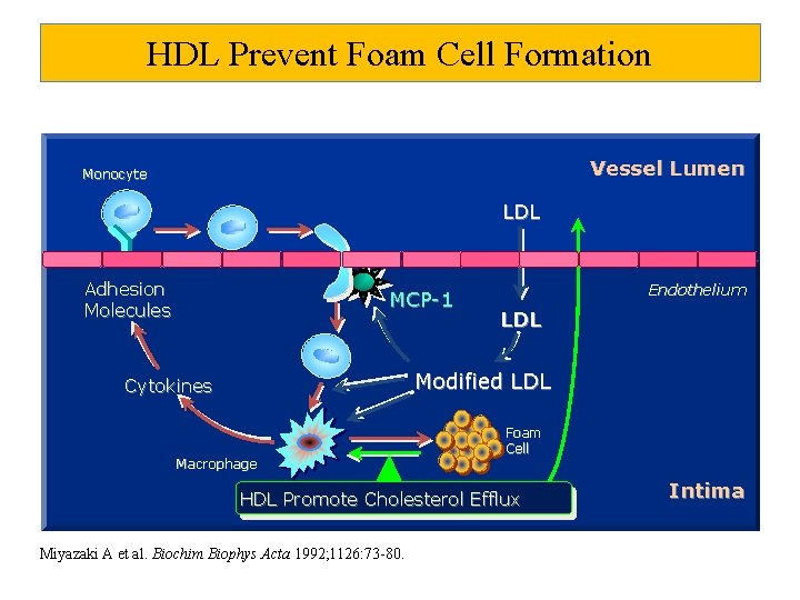HDL Prevent Foam Cell Formation Vessel Lumen Monocyte LDL Adhesion Molecules MCP-1 Endothelium LDL