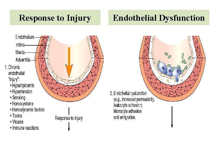 Response to Injury Endothelial Dysfunction 