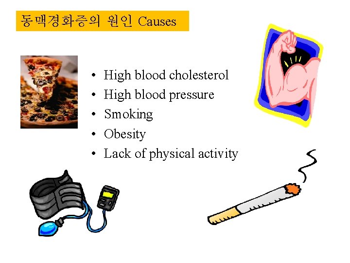 동맥경화증의 원인 Causes • • • High blood cholesterol High blood pressure Smoking Obesity