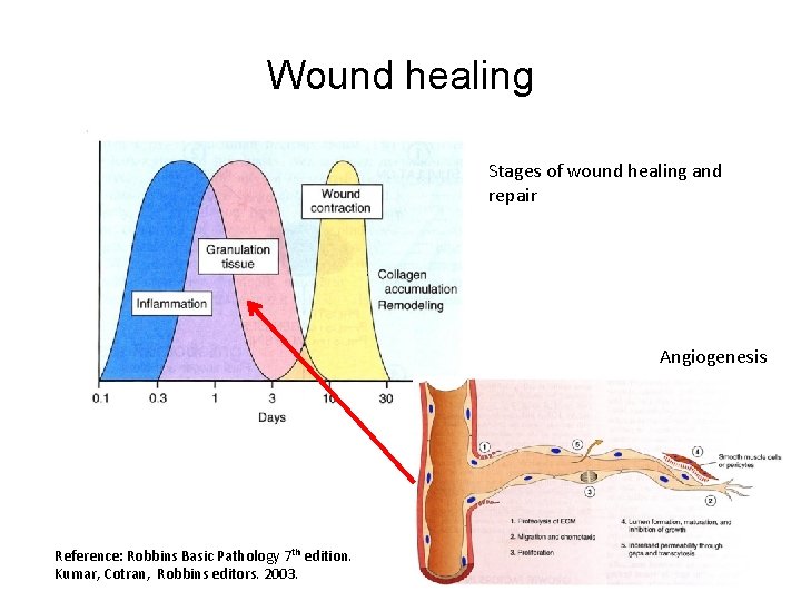 Wound healing Stages of wound healing and repair Angiogenesis Reference: Robbins Basic Pathology 7