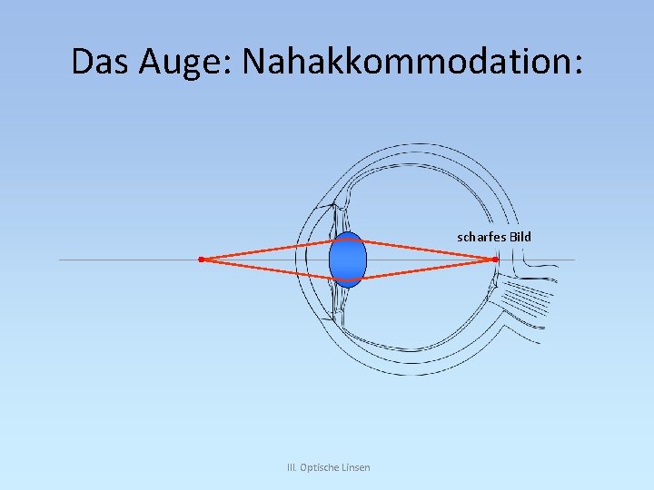 Das Auge: Nahakkommodation: scharfes Bild III. Optische Linsen 