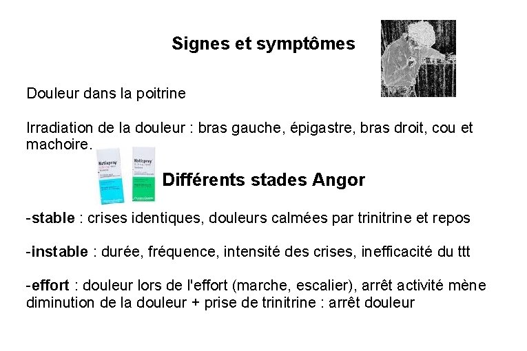 Signes et symptômes Douleur dans la poitrine Irradiation de la douleur : bras gauche,