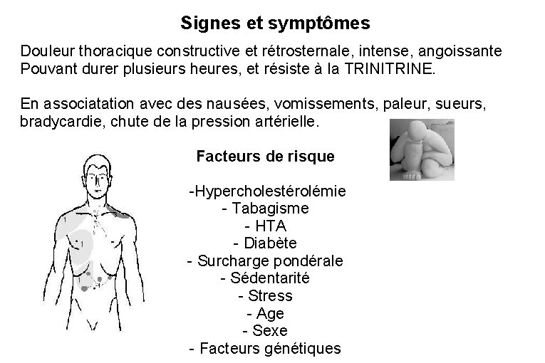 Signes et symptômes Douleur thoracique constructive et rétrosternale, intense, angoissante Pouvant durer plusieurs heures,