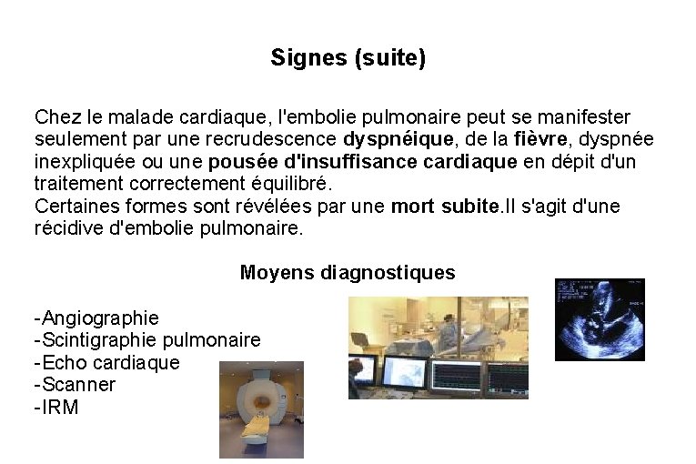 Signes (suite) Chez le malade cardiaque, l'embolie pulmonaire peut se manifester seulement par une