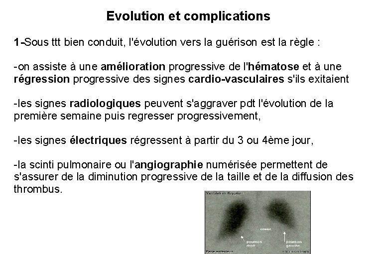 Evolution et complications 1 -Sous ttt bien conduit, l'évolution vers la guérison est la