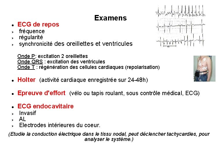  ECG de repos fréquence Examens régularité synchronicité des oreillettes et ventricules Onde P: