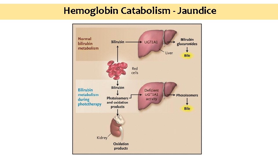 Hemoglobin Catabolism - Jaundice 