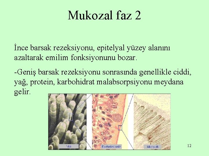 Mukozal faz 2 İnce barsak rezeksiyonu, epitelyal yüzey alanını azaltarak emilim fonksiyonunu bozar. -Geniş