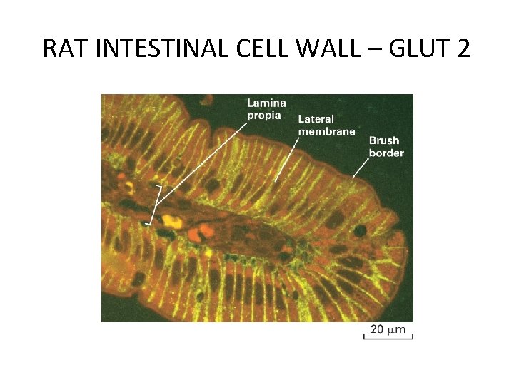 RAT INTESTINAL CELL WALL – GLUT 2 RAT INTESTINAL CELL WALL – GLUT 2