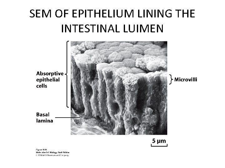 SEM OF EPITHELIUM LINING THE INTESTINAL LUIMEN SEM OF EPITHELIUM LINING THE INTESTINAL LUIMEN