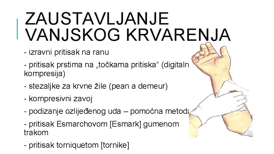 ZAUSTAVLJANJE VANJSKOG KRVARENJA - izravni pritisak na ranu - pritisak prstima na „točkama pritiska”