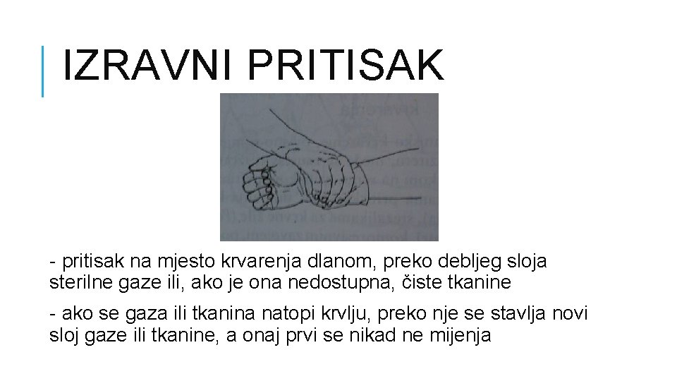 IZRAVNI PRITISAK - pritisak na mjesto krvarenja dlanom, preko debljeg sloja sterilne gaze ili,