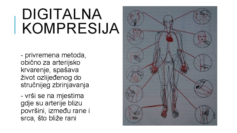 DIGITALNA KOMPRESIJA - privremena metoda, obično za arterijsko krvarenje, spašava život ozlijeđenog do stručnijeg