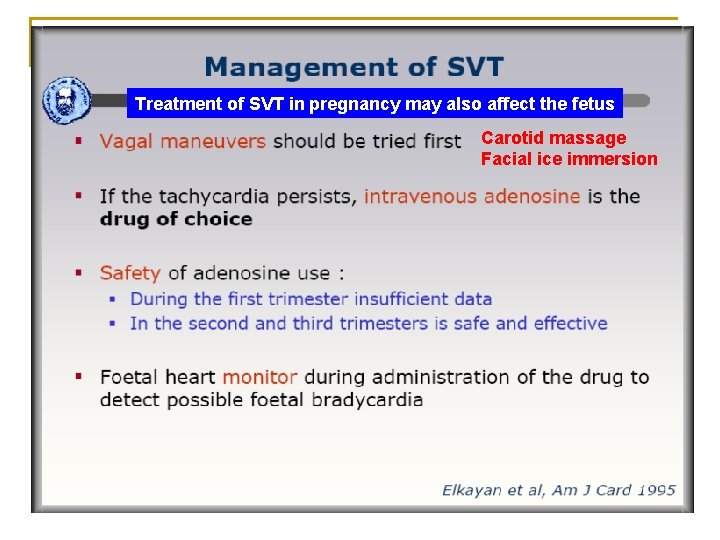 Treatment of SVT in pregnancy may also affect the fetus Carotid massage Facial ice