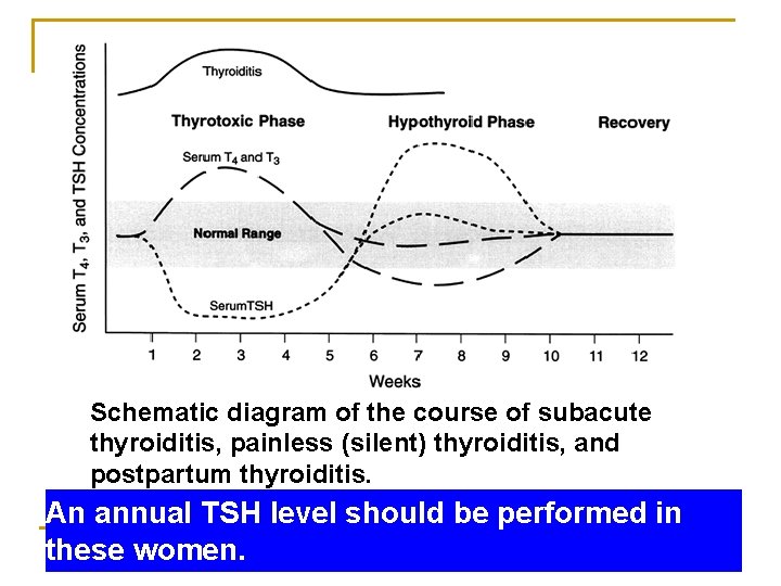 Schematic diagram of the course of subacute thyroiditis, painless (silent) thyroiditis, and postpartum thyroiditis.