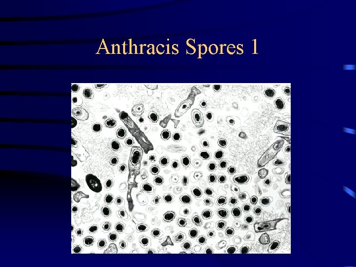 Anthracis Spores 1 