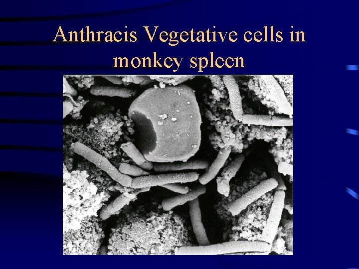 Anthracis Vegetative cells in monkey spleen 