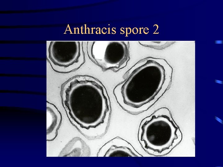 Anthracis spore 2 