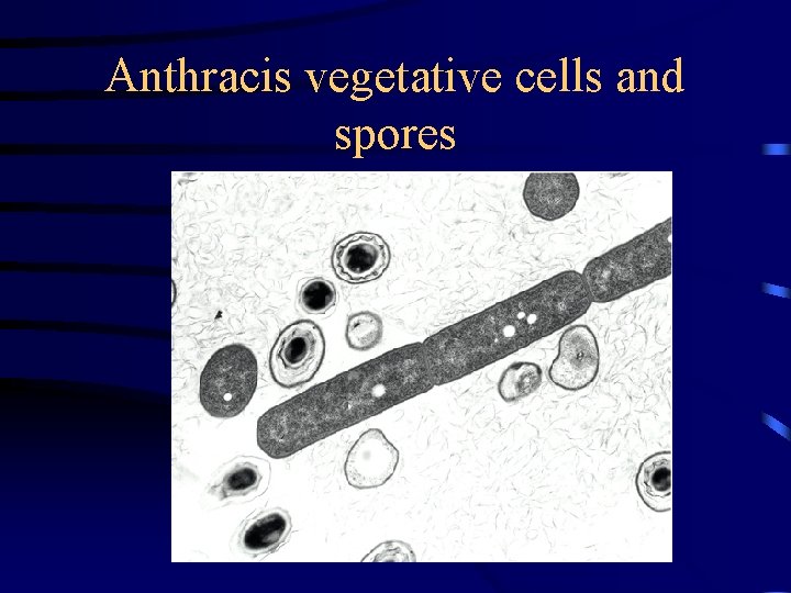 Anthracis vegetative cells and spores 